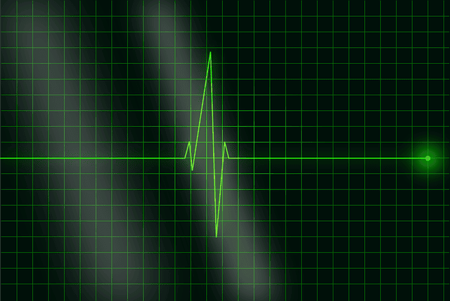 electrocardiogram